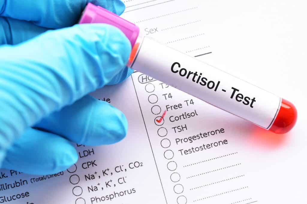 The Correlation Between Cortisol and Blood Sugar