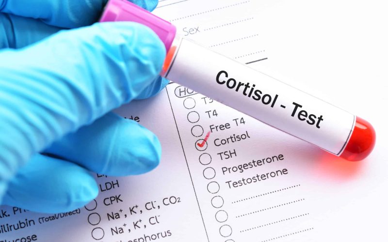 The-Correlation-Between-Cortisol-and-Blood-Sugar